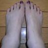 twisted left ankle