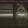 02 ultrasound heartbeat