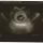 02 ultrasound2