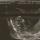 04 ultrasound2