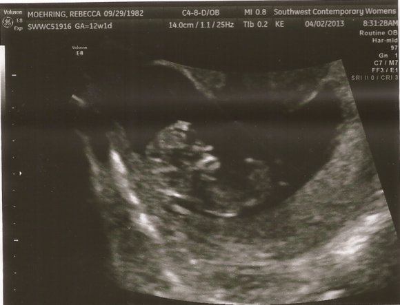 04 ultrasound2