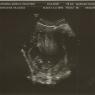 04 ultrasound3