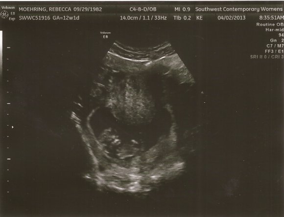 04 ultrasound3