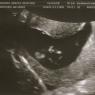 04 ultrasound4