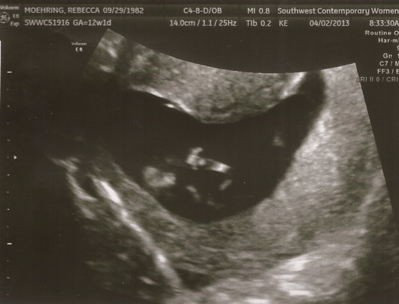 04 ultrasound4