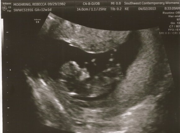 04 ultrasound