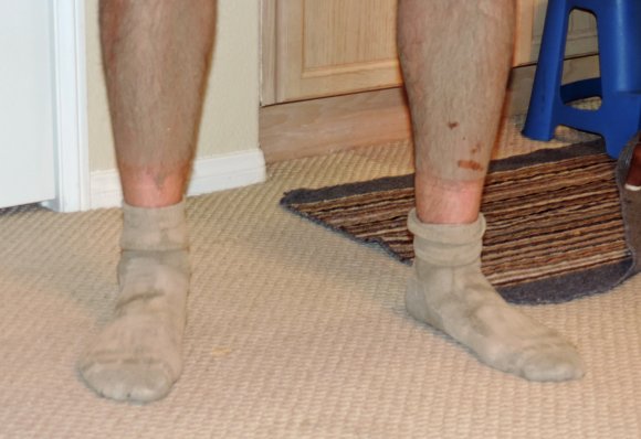 dirty feet