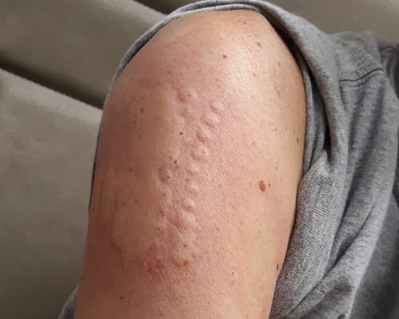 01 arm