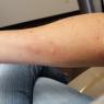 02 arm