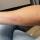 02 arm