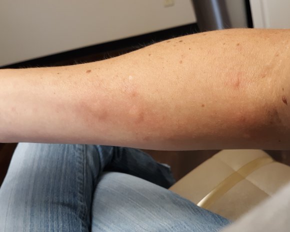 02 arm