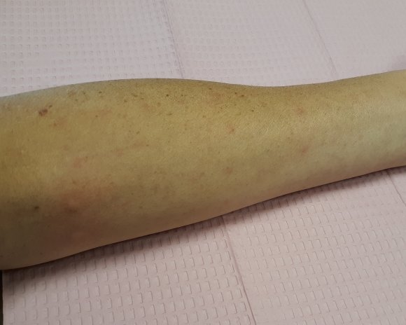 03 arm