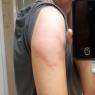 05 arm