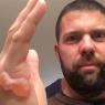35 nate wart