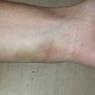 36 becca weird bruise