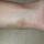 36 becca weird bruise