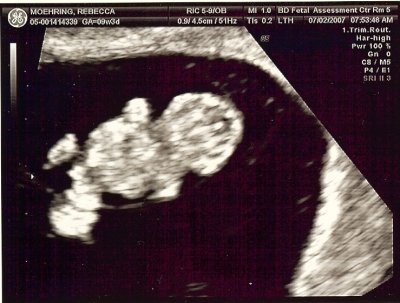 ultrasound_7-2