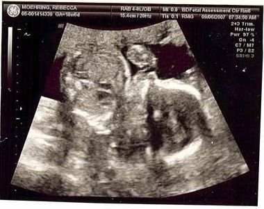 ultrasound_9-6_2