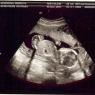 ultrasound_9-6