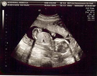 ultrasound_9-6