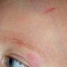 first head bump