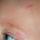 first head bump
