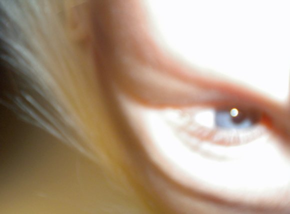 11 hannah eye