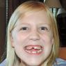 30 hannah no teeth