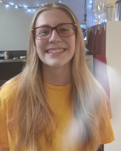 08 no braces