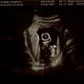 05-18 alien