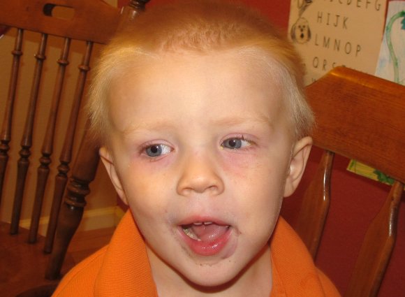 Ben's eyes before bed