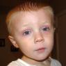 Ben's goopy eyes after bed