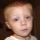 Ben's goopy eyes after bed