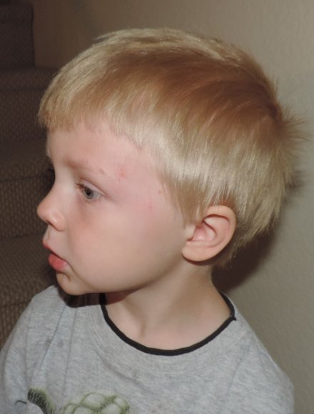 06 ben fell down stairs