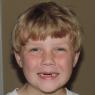 11 benjamin no teeth