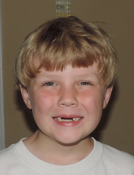 11 benjamin no teeth