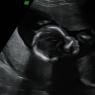 09 23 profile