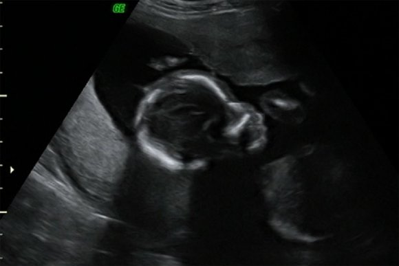 09 23 profile
