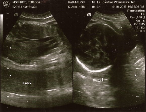 01 06 ultrasound