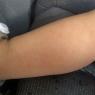08 rash