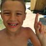 24 joel tooth (2)