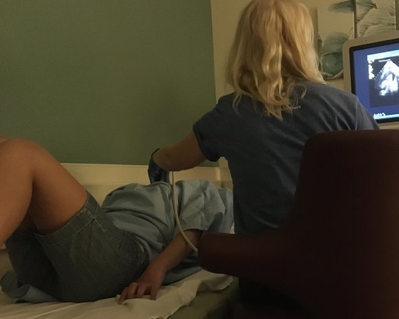 18 ginny heart ultrasound