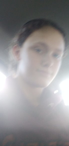 7997525854236613795
