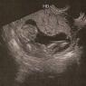 1.10 baby 2