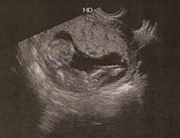 1.10 baby 2