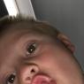 100