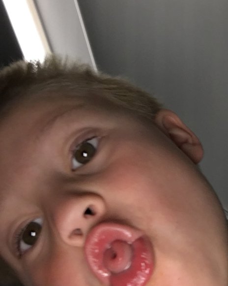 100