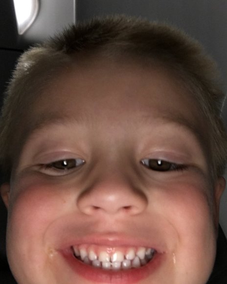98